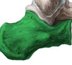 3D image survey of calcaneum fractures